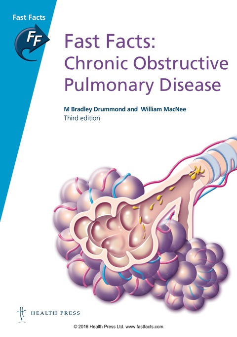 Fast Facts: Chronic Obstructive Pulmonary Disease 