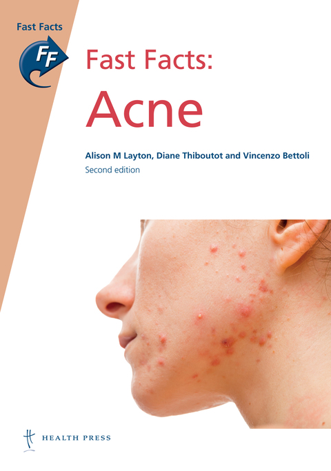 Cover image for book Fast Facts: Acne