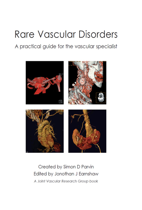 Cover image for book Rare Vascular Disorders