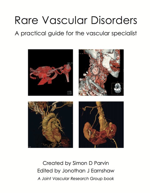Cover image for book Rare Vascular Disorders