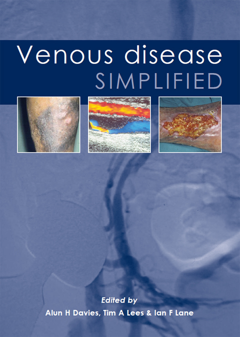 Cover image for book Venous Disease Simplified
