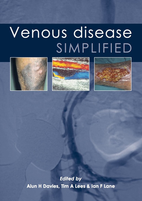 Cover image for book Venous Disease Simplified