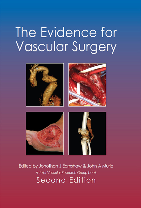 Cover image for book The Evidence for Vascular Surgery; second edition
