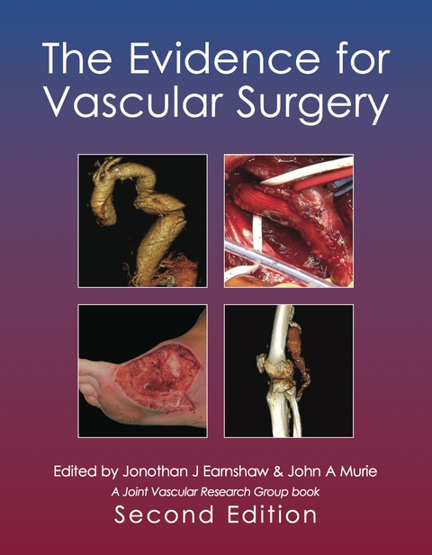 Cover image for book The Evidence for Vascular Surgery; second edition