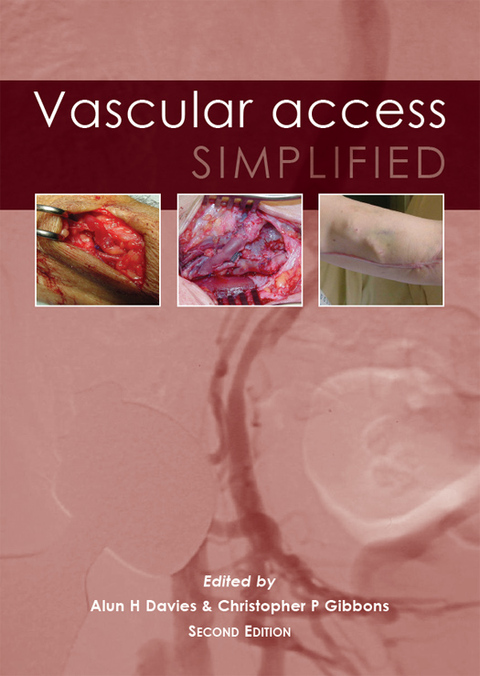 Cover image for book Vascular Access Simplified; second edition