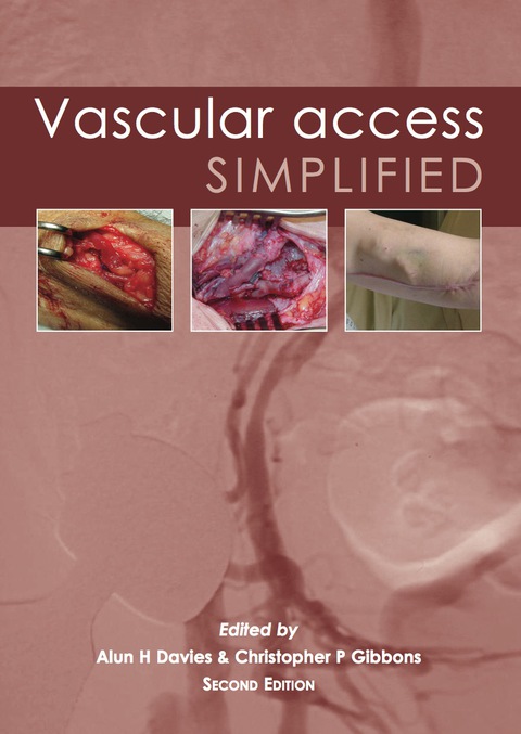 Cover image for book Vascular Access Simplified; second edition