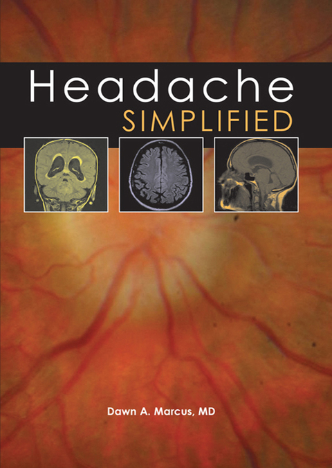 Cover image for book Headache Simplified