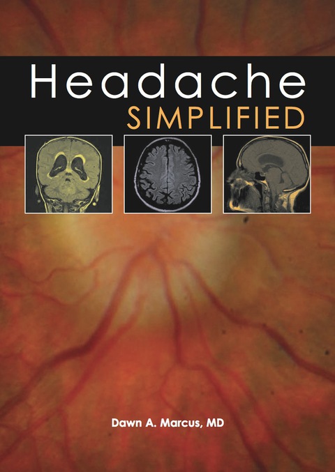 Cover image for book Headache Simplified