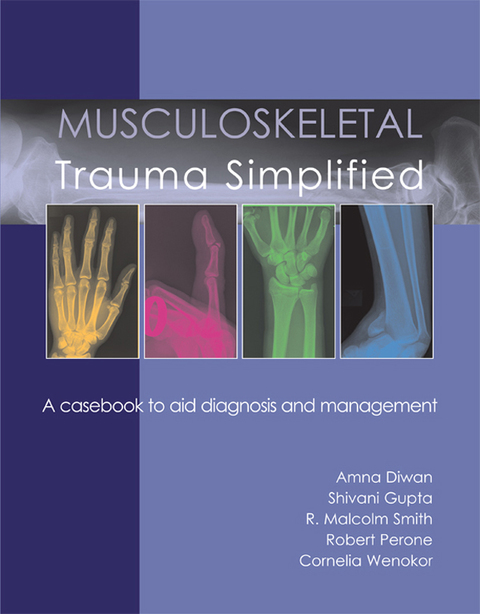 Cover image for book Musculoskeletal Trauma Simplified