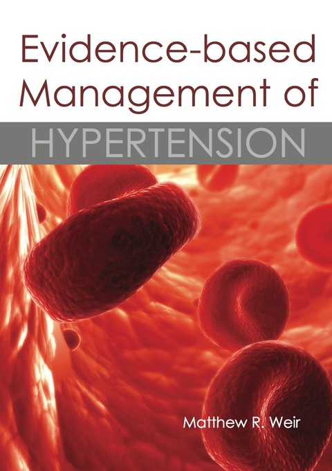 Cover image for book Evidence-based Management of Hypertension