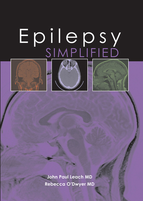 Cover image for book Epilepsy Simplified