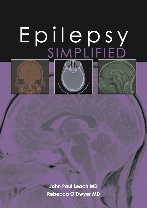 Cover image for book Epilepsy Simplified