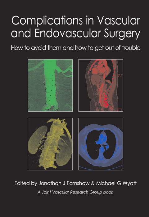 Cover image for book Complications in Vascular and Endovascular Surgery