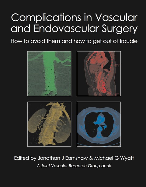 Cover image for book Complications in Vascular and Endovascular Surgery
