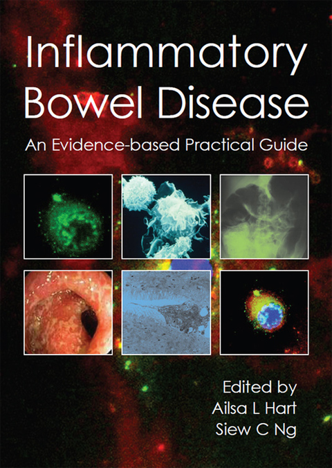 Cover image for book Inflammatory Bowel Disease