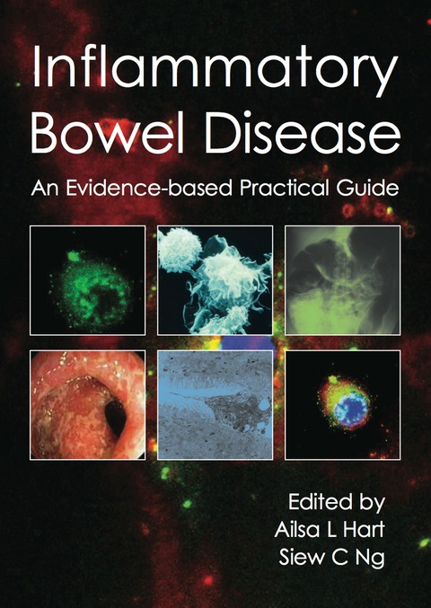 Cover image for book Inflammatory Bowel Disease