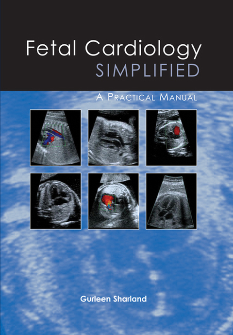 Cover image for book Fetal Cardiology Simplified