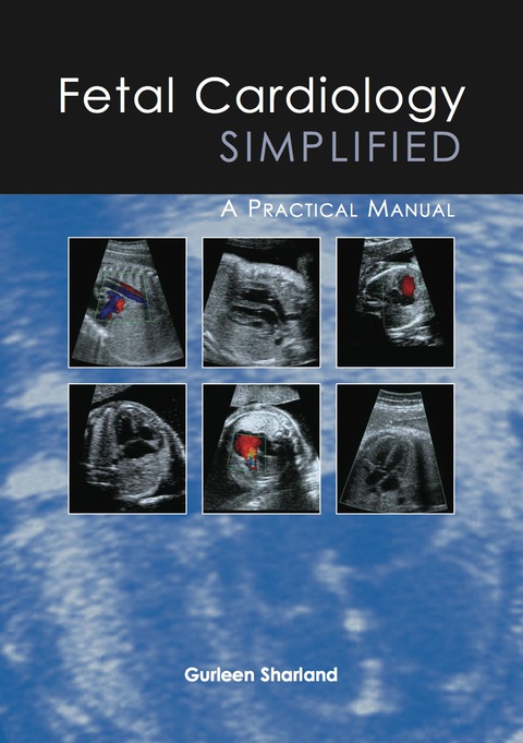 Cover image for book Fetal Cardiology Simplified