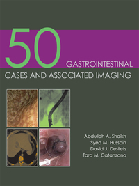 Cover image: 50 Gastrointestinal Cases and Associated Imaging 1st edition 9781903378854
