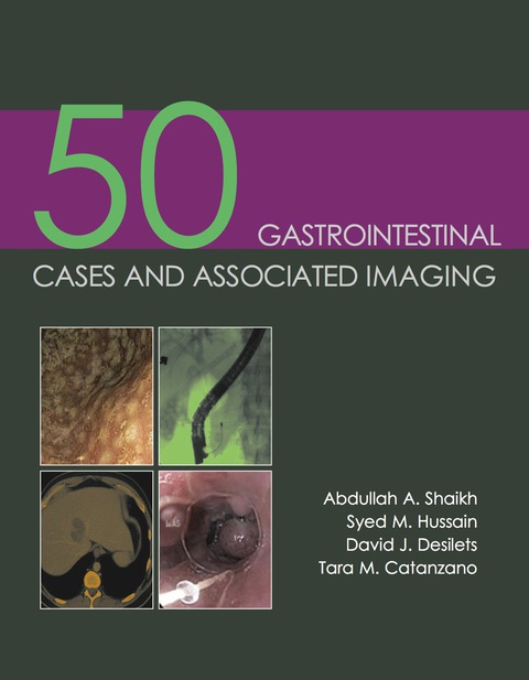 Cover image for book 50 Gastrointestinal Cases and Associated Imaging