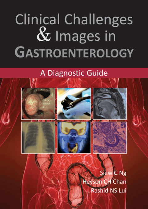 Cover image for book Clinical Challenges & Images in Gastroenterology