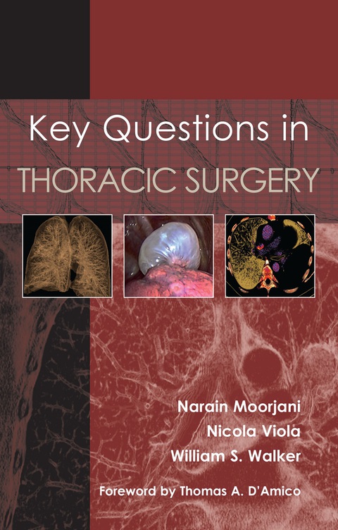 Cover image for book Key Questions in Thoracic Surgery