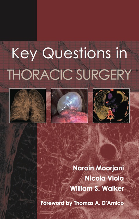 Cover image for book Key Questions in Thoracic Surgery