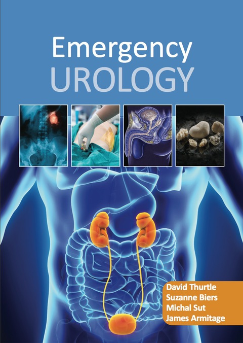 Cover image for book Emergency Urology