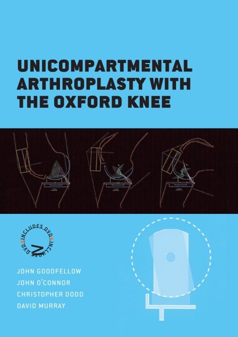 Cover image for book Unicompartmental Arthroplasty with the Oxford Knee