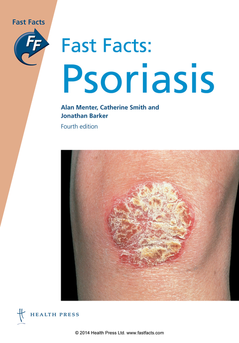 Fast Facts: Psoriasis 