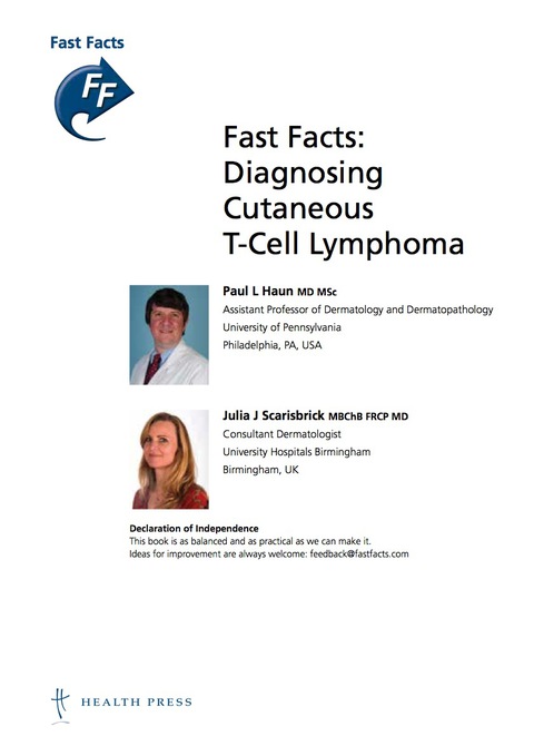 Fast Facts: Diagnosing Cutaneous T-cell Lymphoma 