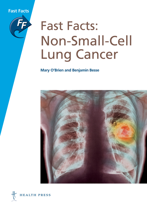 Fast Facts: Non-Small-Cell Lung Cancer 