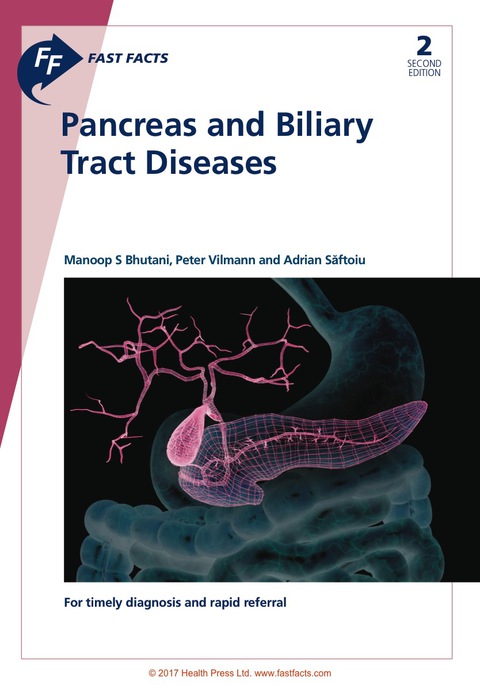 Fast Facts: Pancreas and Biliary Tract Diseases 