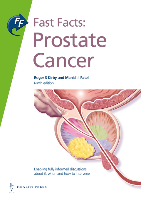 Fast Facts: Prostate Cancer 