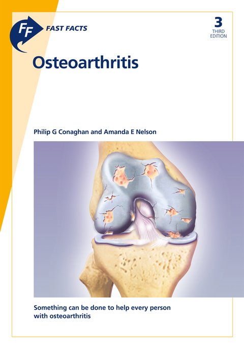 Fast Facts: Osteoarthritis 