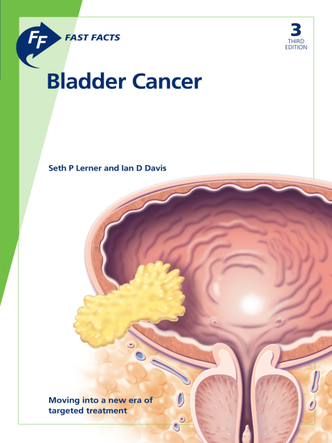 Fast Facts: Bladder Cancer 