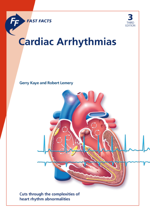 Fast Facts: Cardiac Arrhythmias 