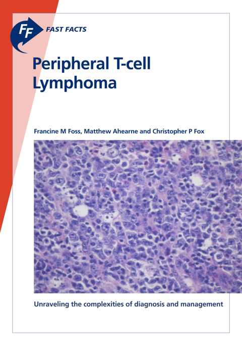 Cover image for book Fast Facts: Peripheral T-cell Lymphoma