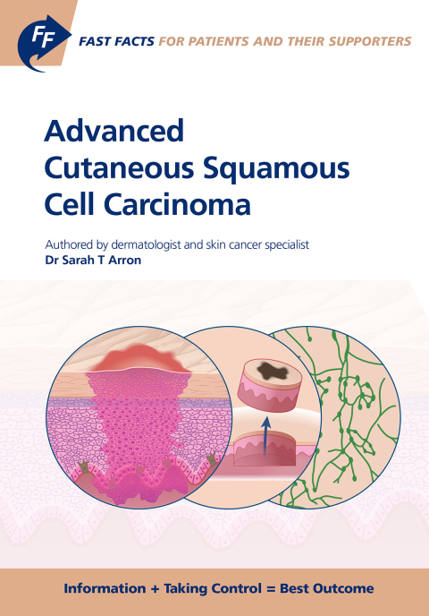 Fast Facts: Advanced Cutaneous Squamous Cell Carcinoma for Patients and their Supporters 