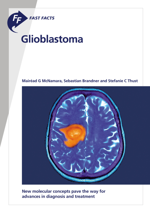 Cover image for book Fast Facts: Glioblastoma