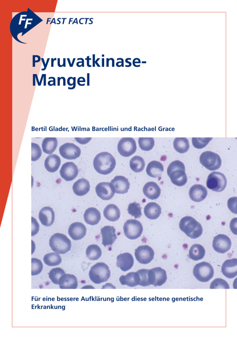Cover image for book Fast Facts: Pyruvatkinase-Mangel