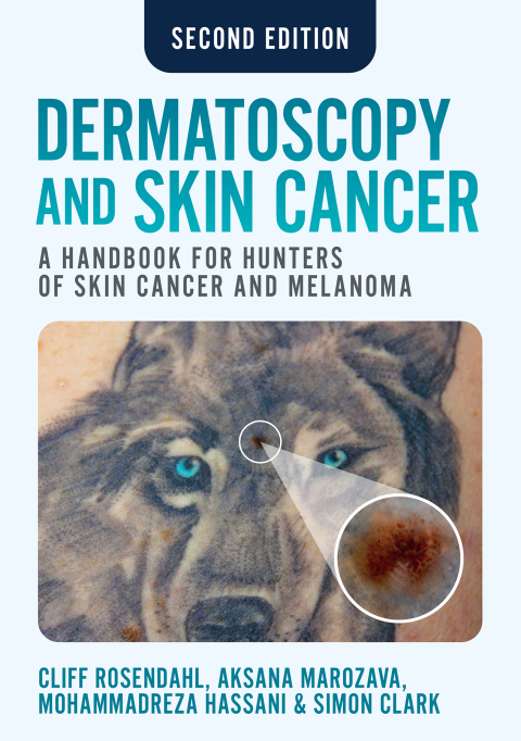 Cover image for book Dermatoscopy and Skin Cancer
