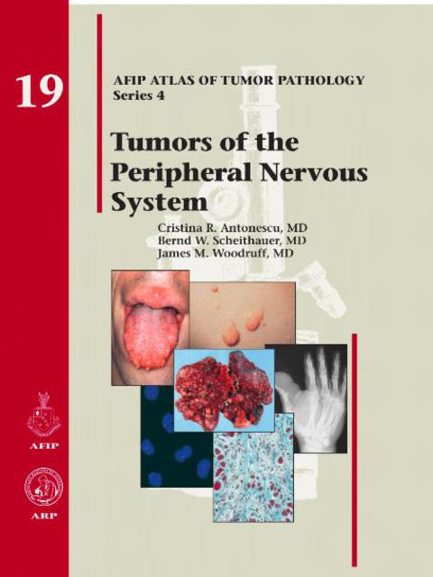 Cover image for book Tumors of the Peripheral Nervous System
