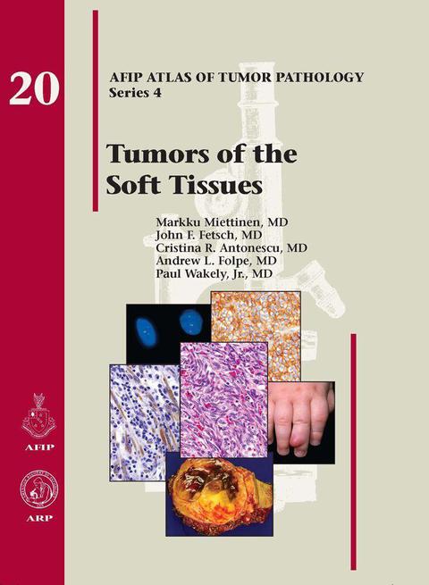 Cover image for book Tumors of the Soft Tissues