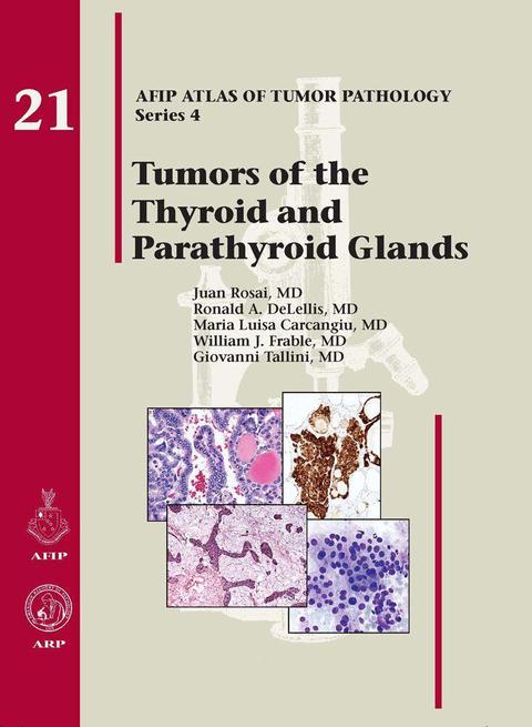 Cover image for book Tumors of the Thyroid and Parathyroid Glands