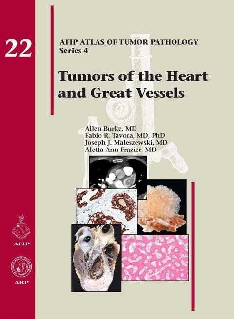 Cover image for book Tumors of the Heart and Great Vessels