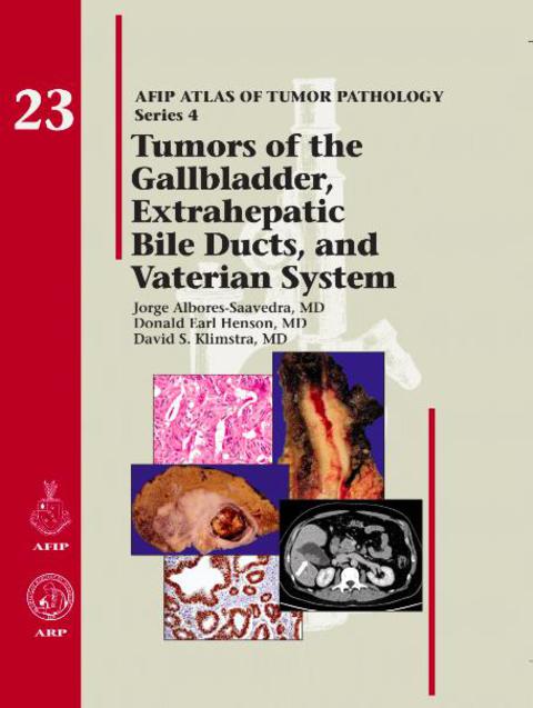 Cover image for book Tumors of the Gallbladder, Extrahepatic Bile Ducts, and Vaterian System