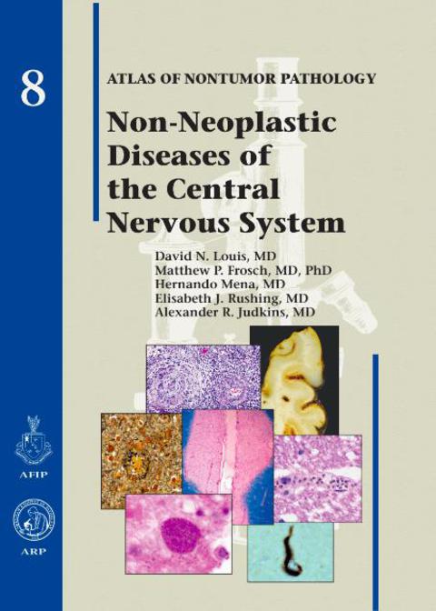 Cover image for book Non-Neoplastic Diseases of the Central Nervous System