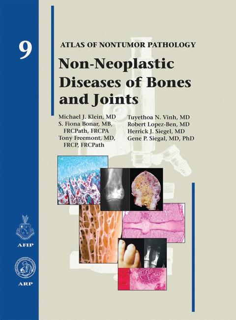 Cover image for book Non-Neoplastic Diseases of Bones and Joints