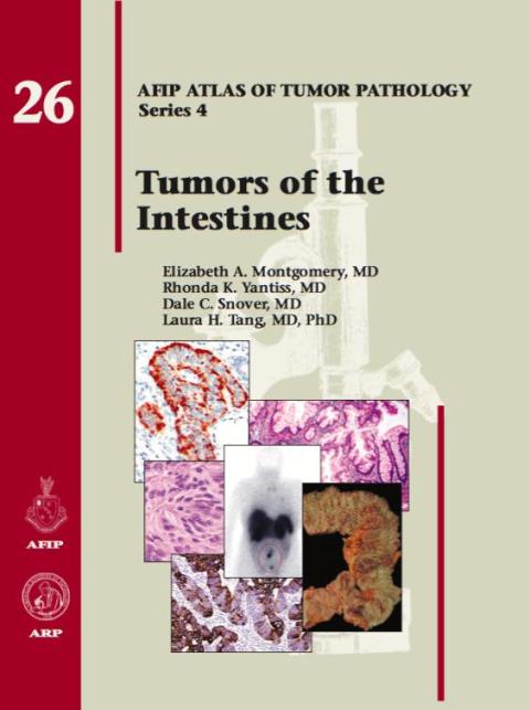 Cover image for book Tumors of the Intestines